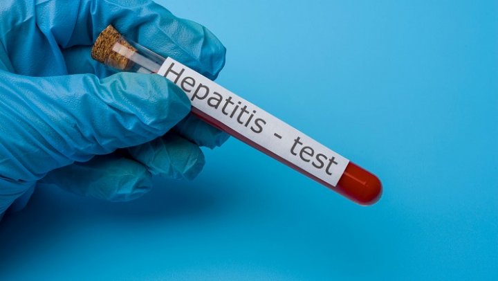 C&oacute;mo se trat&oacute; en Gran Breta&ntilde;a a los casos de hepatitis aguda de causa desconocida