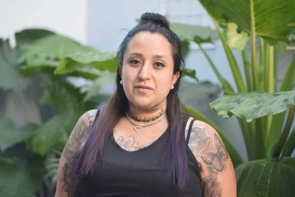 Érika Altamiranda, se quemó el 40% del cuerpo en un accidente doméstico: "Sufría una depresión muy grande y lo que me pasó me ayudó a salir"