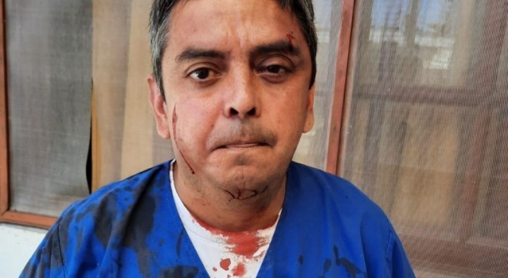 Marcelo Cachagua: "Me pegó diciéndome que casi se muere de Covid por mi culpa"